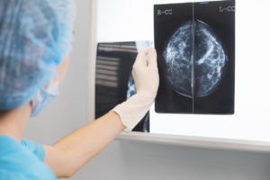 Breast Cancer Misdiagnosis