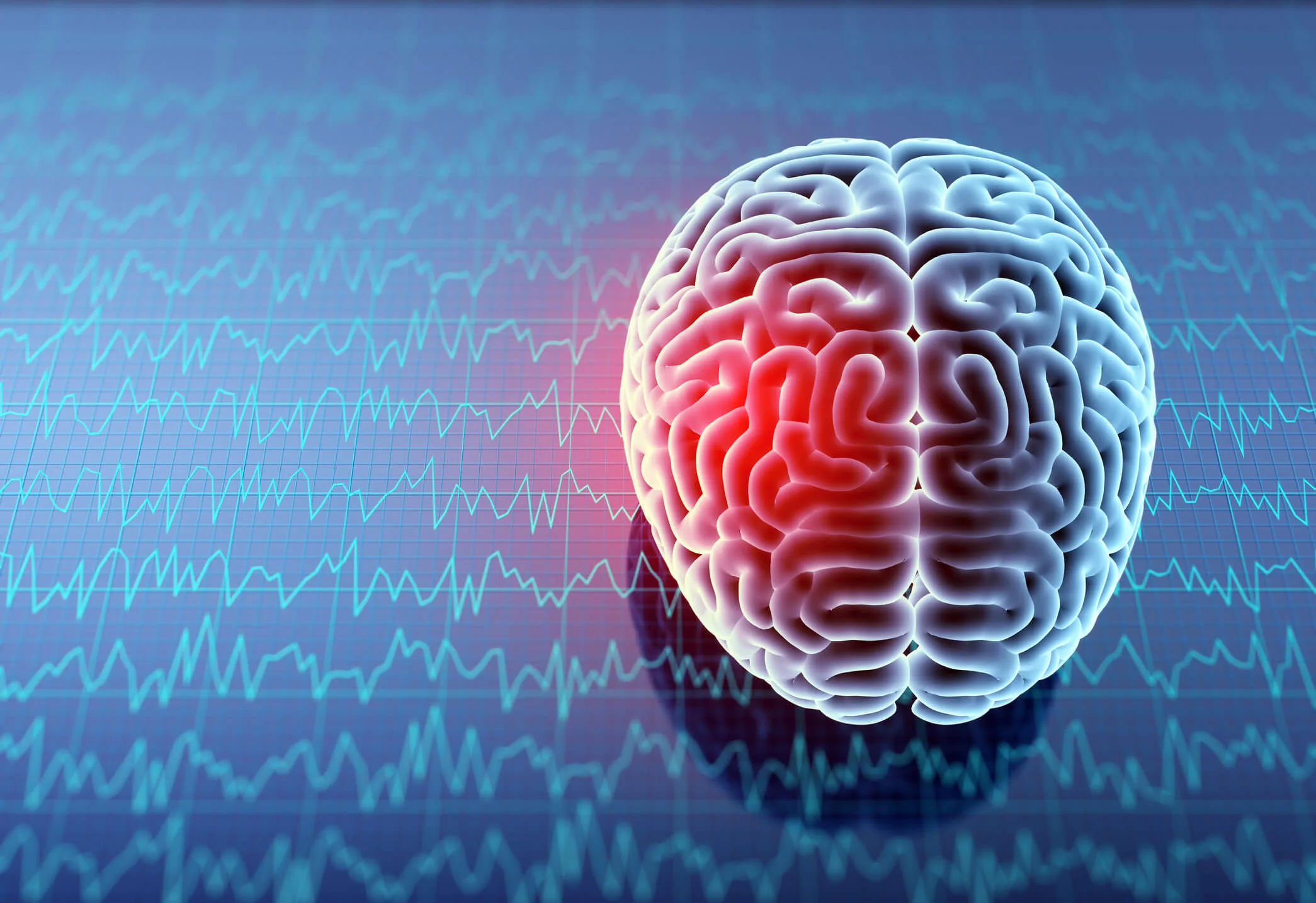 Brain injuries in teens can have long-lasting cognitive impacts