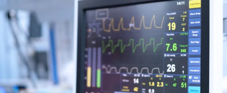 Pulse on hospital monitor